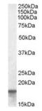 Anterior Gradient 2, Protein Disulphide Isomerase Family Member antibody, orb19378, Biorbyt, Western Blot image 