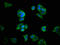 Homeobox A11 antibody, LS-C680617, Lifespan Biosciences, Immunofluorescence image 
