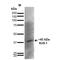 Potassium Voltage-Gated Channel Subfamily J Member 8 antibody, MA5-27679, Invitrogen Antibodies, Western Blot image 