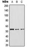 Cyclin Dependent Kinase 8 antibody, orb216058, Biorbyt, Western Blot image 