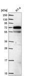 Endonuclease/Exonuclease/Phosphatase Family Domain Containing 1 antibody, NBP2-58531, Novus Biologicals, Western Blot image 