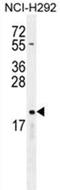 Cytochrome B-245 Alpha Chain antibody, AP51159PU-N, Origene, Western Blot image 