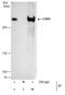 Chromodomain Helicase DNA Binding Protein 4 antibody, PA5-32181, Invitrogen Antibodies, Immunoprecipitation image 