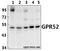 G Protein-Coupled Receptor 52 antibody, A13015-1, Boster Biological Technology, Western Blot image 