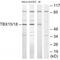 T-Box 15 antibody, A08871, Boster Biological Technology, Western Blot image 