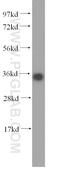 Potassium Voltage-Gated Channel Subfamily J Member 15 antibody, 15988-1-AP, Proteintech Group, Western Blot image 