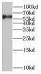 Solute Carrier Family 37 Member 1 antibody, FNab07956, FineTest, Western Blot image 