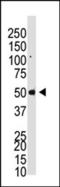 Histone Deacetylase 8 antibody, LS-C96660, Lifespan Biosciences, Western Blot image 