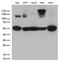 Inhibitor Of Nuclear Factor Kappa B Kinase Regulatory Subunit Gamma antibody, LS-C796360, Lifespan Biosciences, Western Blot image 