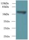 T-Complex 11 Like 2 antibody, A61278-100, Epigentek, Western Blot image 