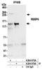 E3 ubiquitin-protein ligase RBBP6 antibody, A304-975A, Bethyl Labs, Immunoprecipitation image 