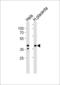 Isocitrate Dehydrogenase (NAD(+)) 3 Beta antibody, 61-033, ProSci, Western Blot image 