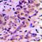 TRNA Methyltransferase 11 Homolog antibody, orb234974, Biorbyt, Immunohistochemistry paraffin image 
