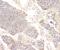 C-C Motif Chemokine Receptor 10 antibody, A04731-1, Boster Biological Technology, Immunohistochemistry paraffin image 