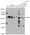 Regulator Of G Protein Signaling 20 antibody, GTX32838, GeneTex, Western Blot image 