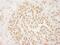 Protein Arginine Methyltransferase 6 antibody, NB110-40713, Novus Biologicals, Immunohistochemistry paraffin image 