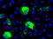 Sonic Hedgehog Signaling Molecule antibody, M00058-1, Boster Biological Technology, Immunofluorescence image 
