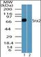 Sorting Nexin 2 antibody, orb95750, Biorbyt, Western Blot image 