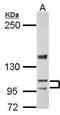 Sarcoplasmic/endoplasmic reticulum calcium ATPase 3 antibody, PA5-27691, Invitrogen Antibodies, Western Blot image 
