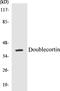 Neuronal migration protein doublecortin antibody, EKC1174, Boster Biological Technology, Western Blot image 