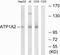 ATPase Na+/K+ Transporting Subunit Alpha 2 antibody, LS-C198652, Lifespan Biosciences, Western Blot image 