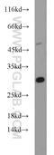 Density Regulated Re-Initiation And Release Factor antibody, 10656-1-AP, Proteintech Group, Western Blot image 