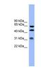 Serpin Family A Member 4 antibody, NBP1-79743, Novus Biologicals, Western Blot image 