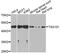 Tumor Susceptibility 101 antibody, A1692, ABclonal Technology, Western Blot image 