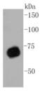 Protein Arginine Methyltransferase 5 antibody, NBP2-67515, Novus Biologicals, Western Blot image 