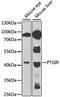 Prostaglandin I2 Receptor antibody, MBS127986, MyBioSource, Western Blot image 