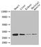 Adiponectin, C1Q And Collagen Domain Containing antibody, LS-C212129, Lifespan Biosciences, Western Blot image 