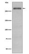 Fibronectin 1 antibody, M00564-1, Boster Biological Technology, Western Blot image 