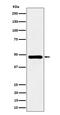 Sorting Nexin 5 antibody, M04788, Boster Biological Technology, Western Blot image 