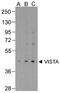 Platelet receptor Gi24 antibody, M32320, Boster Biological Technology, Western Blot image 