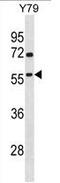 TATA-Box Binding Protein Associated Factor, RNA Polymerase I Subunit A antibody, AP54143PU-N, Origene, Western Blot image 