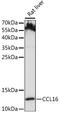 C-C Motif Chemokine Ligand 16 antibody, LS-C750288, Lifespan Biosciences, Western Blot image 