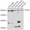 SET Domain Containing 2, Histone Lysine Methyltransferase antibody, GTX64431, GeneTex, Western Blot image 