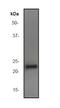 Ras Homolog Family Member A antibody, ab40673, Abcam, Western Blot image 