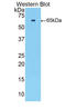 Troponin C2, Fast Skeletal Type antibody, LS-C373105, Lifespan Biosciences, Western Blot image 