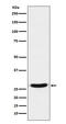 Transcription factor 21 antibody, M05375, Boster Biological Technology, Western Blot image 