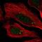 Centrosomal Protein 112 antibody, NBP1-84539, Novus Biologicals, Immunocytochemistry image 