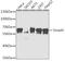 SMAD Family Member 4 antibody, GTX32880, GeneTex, Western Blot image 