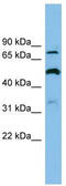 Solute Carrier Family 26 Member 1 antibody, TA333711, Origene, Western Blot image 