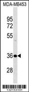 DnaJ Heat Shock Protein Family (Hsp40) Member B2 antibody, 60-205, ProSci, Western Blot image 