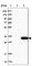 AlkB Homolog 7 antibody, HPA039571, Atlas Antibodies, Western Blot image 