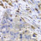 S100 Calcium Binding Protein A8 antibody, A1688, ABclonal Technology, Immunohistochemistry paraffin image 