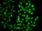 Proteasome 26S Subunit, Non-ATPase 8 antibody, LS-C346379, Lifespan Biosciences, Immunofluorescence image 