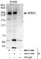 Ras-responsive element-binding protein 1 antibody, NBP1-71884, Novus Biologicals, Western Blot image 