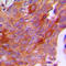 Choriogonadotropin subunit beta antibody, LS-B16073, Lifespan Biosciences, Immunohistochemistry frozen image 
