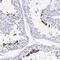 Transcription Elongation Factor A Like 3 antibody, PA5-63637, Invitrogen Antibodies, Immunohistochemistry paraffin image 